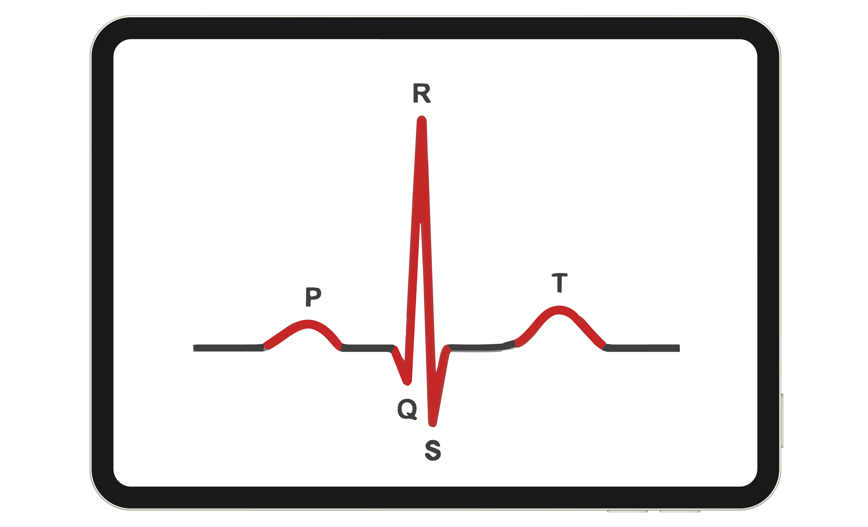 A line graph.